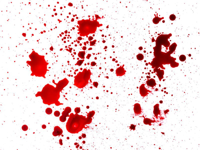 Bloedvlekken verwijderen op professionele werkwijze